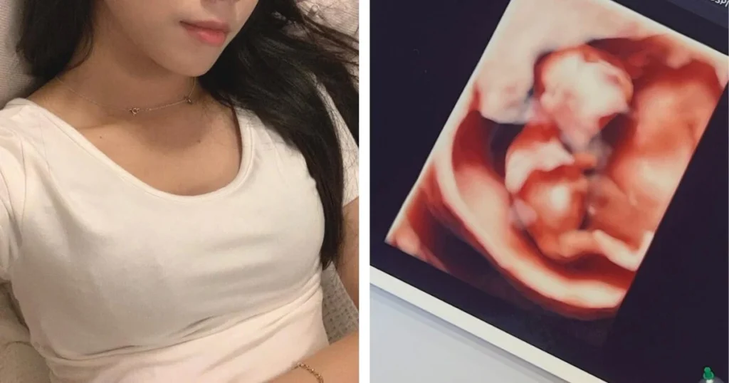 3rd Gen Idol Makes Viral Pregnancy Announcement
