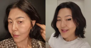 Korean Celeb Shocks With Changed Appearance After Cosmetic Procedure
