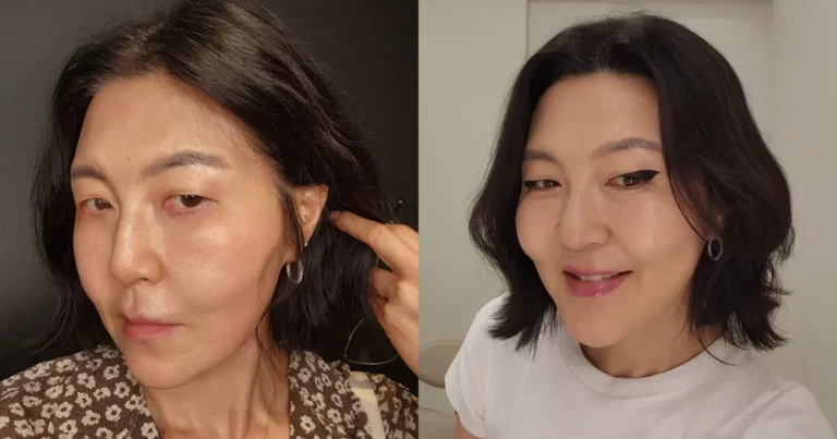 korean-celeb-shocks-with-changed-appearance-after-cosmetic-procedure