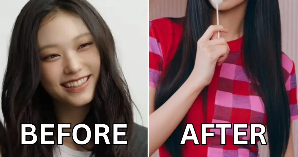 Netizens Erupt in Fury Over Alleged Cosmetic Procedure for NewJeans’ Haerin Following Shocking Comeback