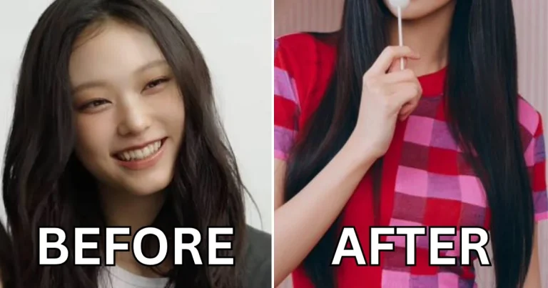 netizens-erupt-in-fury-over-alleged-cosmetic-procedure-for-newjeans-haerin-following-shocking-comeback