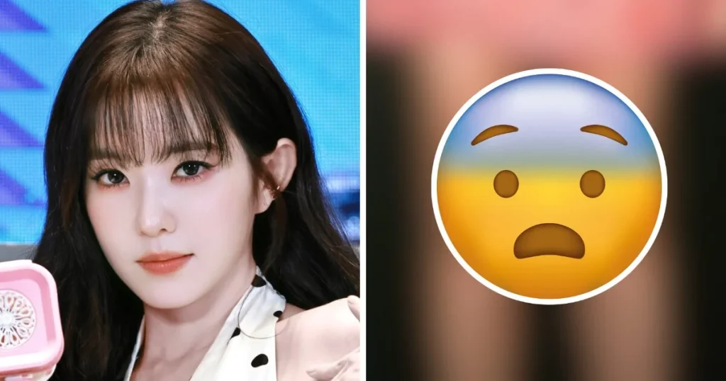 Red Velvet Irene’s Extremely Injured Legs In Viral Photo Spark Shock
