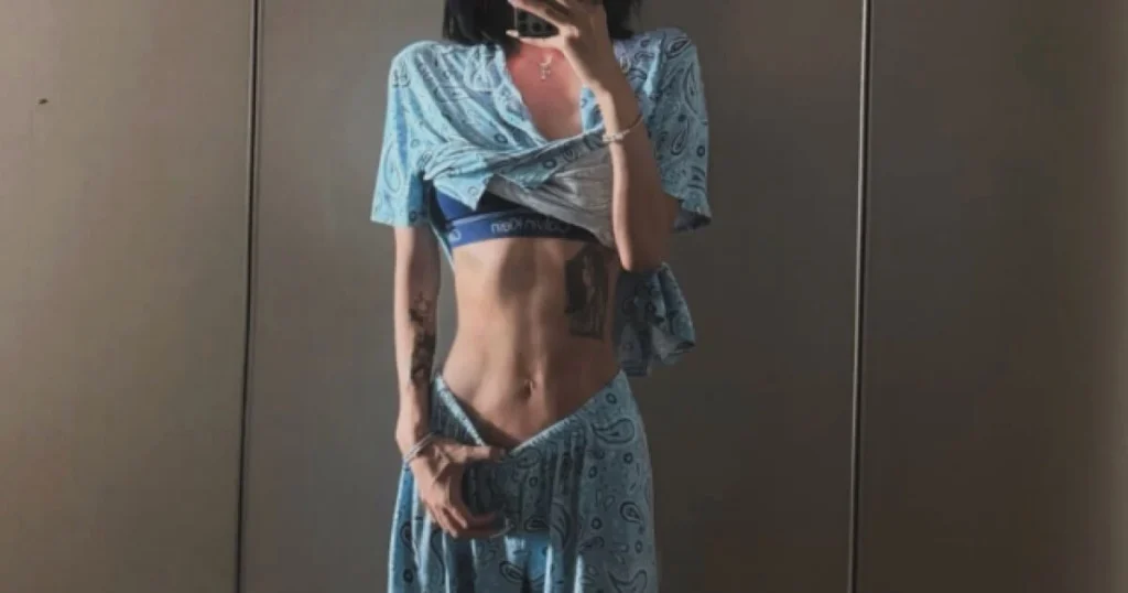 Choi Jun Hee Sparks Global Discussion Over Extreme Physical Transformation and Weight Management Journey Following Battle With Lupus