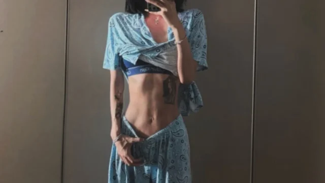 Choi Jun Hee Sparks Global Discussion Over Extreme Physical Transformation and Weight Management Journey Following Battle With Lupus