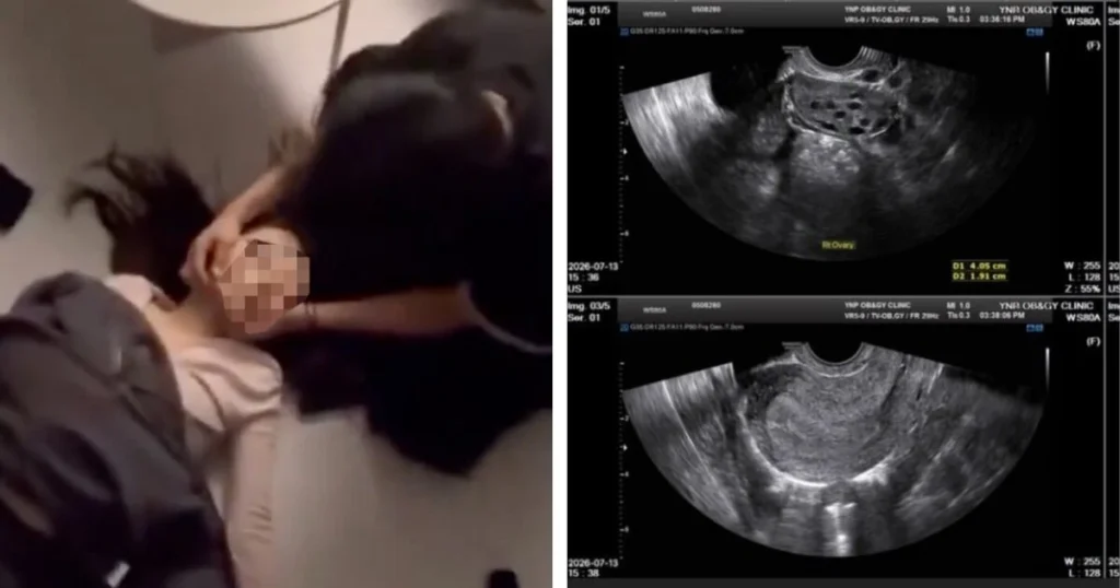 Netflix Actor’s Alleged Ex-Girlfriend Shares Startling Proof Of His Abusive Behavior + Forced Abortion