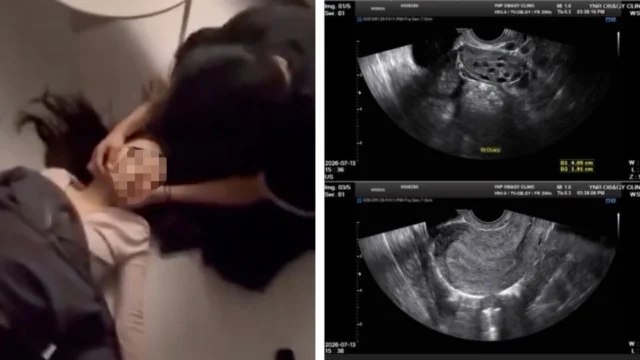 Netflix Actor’s Alleged Ex-Girlfriend Shares Startling Proof Of His Abusive Behavior + Forced Abortion