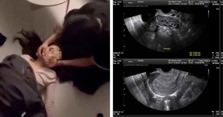 netflix-actors-alleged-ex-girlfriend-shares-startling-proof-of-his-abusive-behavior-forced-abortion